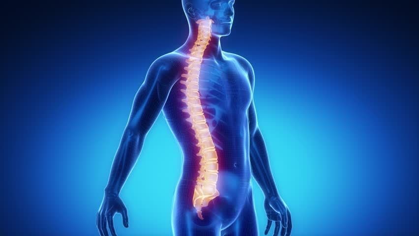 Penggunaan TLSO Brace Tingkatkan Harapan Pasien Skoliosis untuk Sembuh