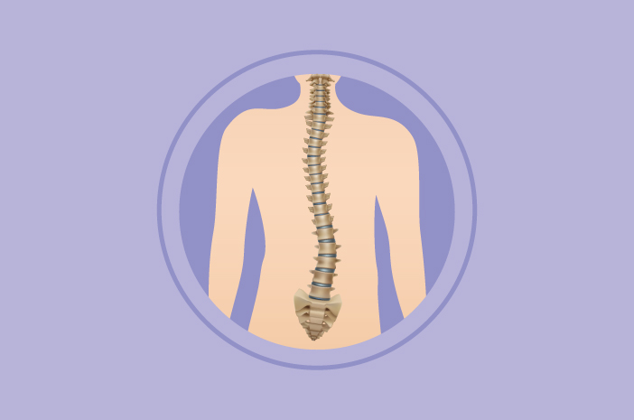 Bagaimana Cara Mengetahui Jika Seseorang Mengidap Skoliosis?