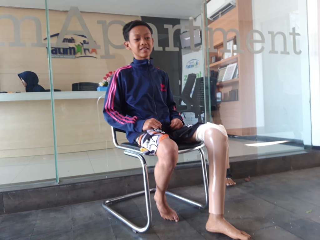 Bagaimana Prostetik dari Tempat Jual Kaki Palsu Surabaya Meningkatkan Kualitas Hidup?