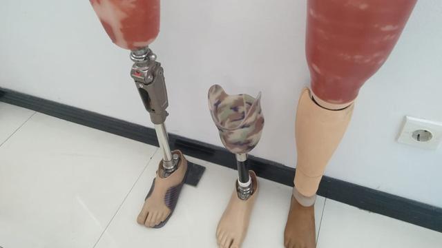 Keuntungan Kaki Palsu dari Tempat Jual Kaki Palsu Jakarta Terbaik