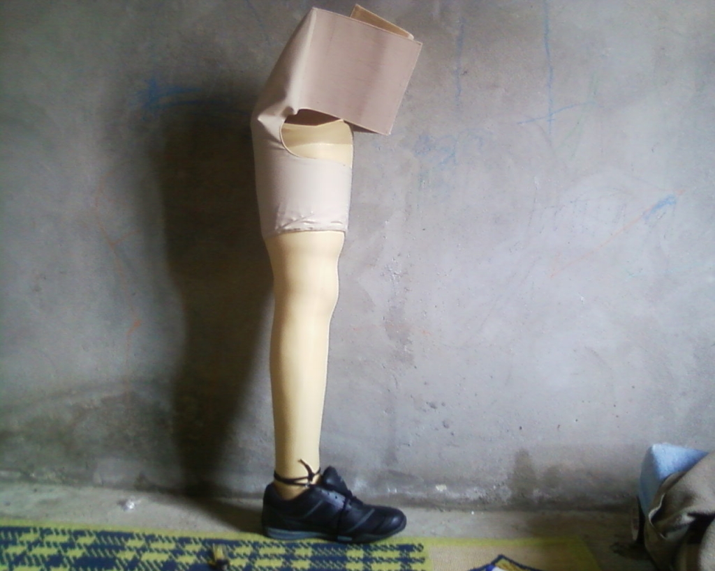 Pentingnya Merawat Kaki Palsu Atas Lutut Supaya Tetap Berfungsi Maksimal