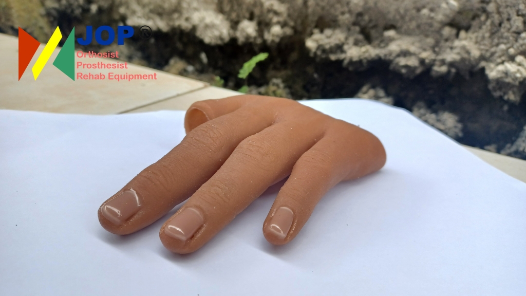 Dengan Bantuan Jari Palsu Melindungi Pasien Amputasi Jari dari Stigma Sosial