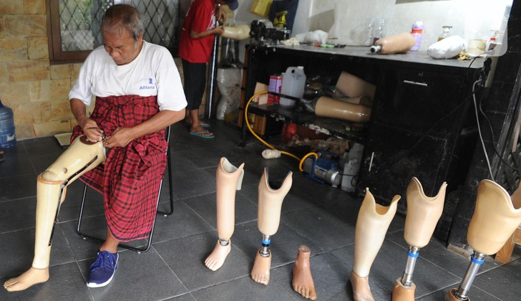 Perawatan Kaki dan Prostetik yang Diperlukan untuk Pasien Amputasi yang Menggunakan Prostetik Kaki Palsu